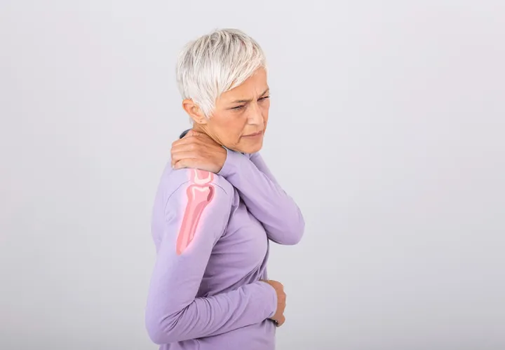 img-condition-frozen-shoulder-720-500 Frozen Shoulder (Adhesive Capsulitis)